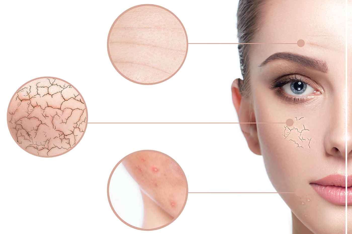 Hydrodermabrasion vs Microdermabrasion? All you need to know StyleSpeak